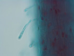 MISSING THUMBNAIL